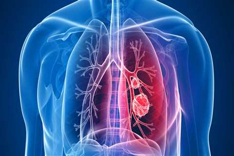 Can mesothelioma affect the heart?