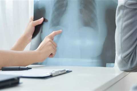 What does asbestos do to the lungs?