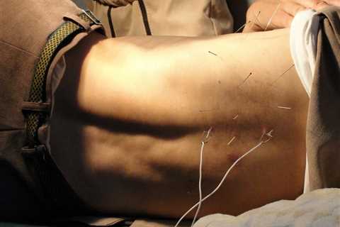 How Long Does it Take to Train in Acupuncture?