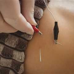 INTRODUCTION TO ACUPUNCTURE TOOLS