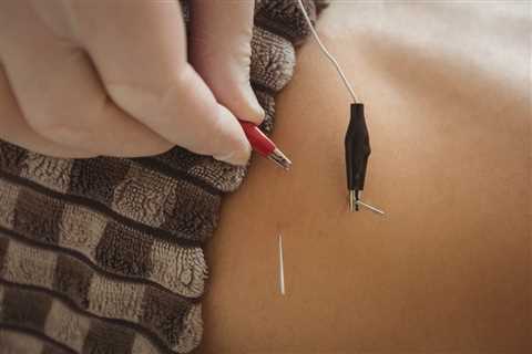 INTRODUCTION TO ACUPUNCTURE TOOLS