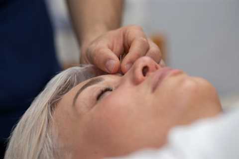 HOW TO USE ACUPUNCTURE FOR CHRONIC MIGRAINES